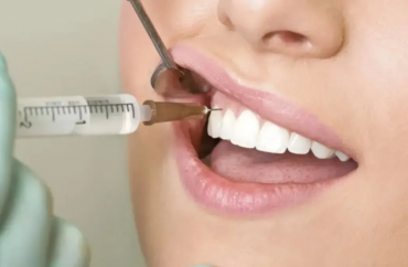 Плазмолифтинг дёсен